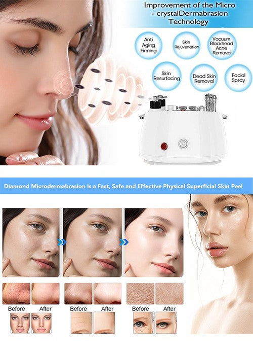 3 in 1 Microdermabrasion Machine Professional Diamond Dermabrasion Facial Devices Homeuse