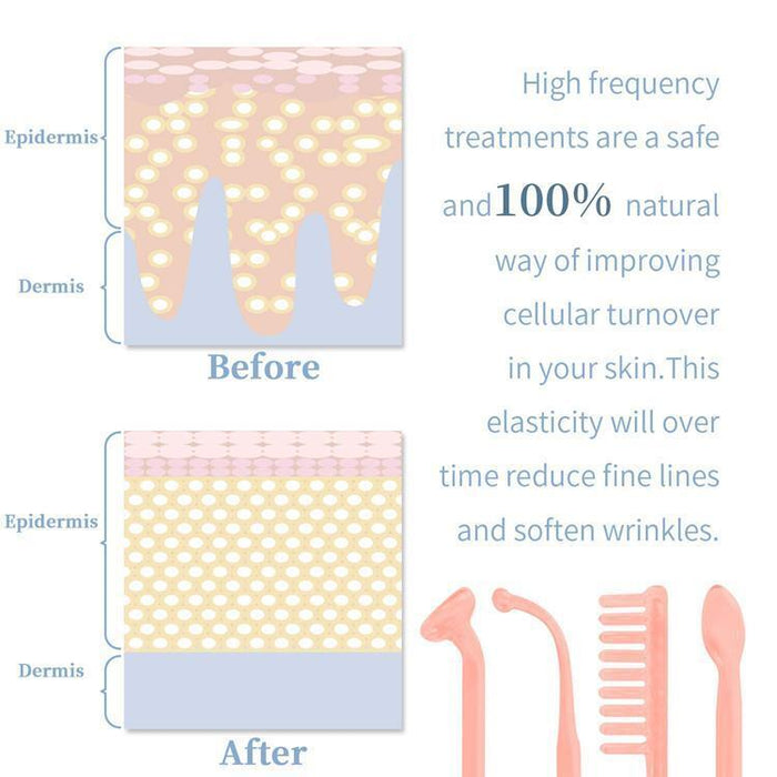 4 in 1 High Frequency Skin Therapy Wand Machine for Acne Treatment Skin Tightening Wrinkle Removal